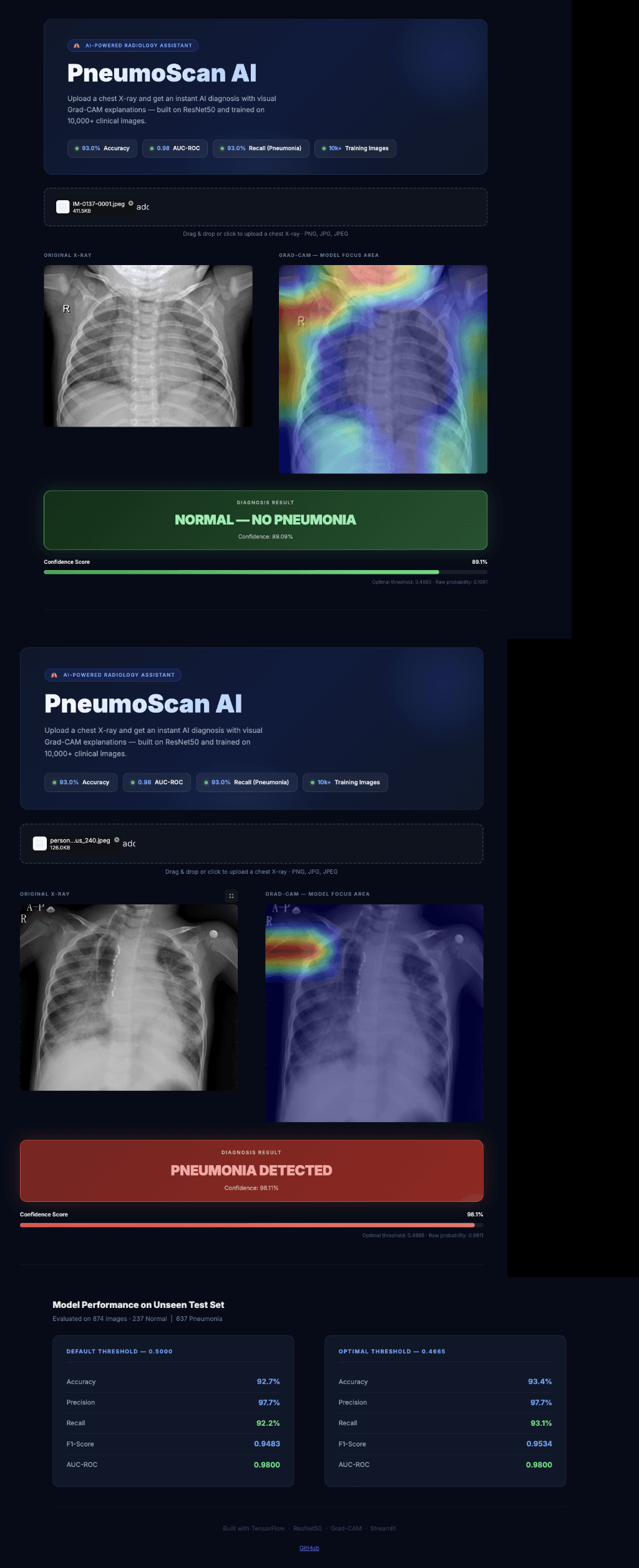 PneumoScan UI